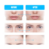 GESS MT Microcurrent facial massager