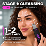 GESS YOU ultrasonic facial cleansing device 3 in 1 — ultrasonic peeling, phonophoresis, face scrubber, pore cleansing from blackheads, care for problem skin and skin with acne