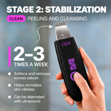 GESS YOU ultrasonic facial cleansing device 3 in 1 — ultrasonic peeling, phonophoresis, face scrubber, pore cleansing from blackheads, care for problem skin and skin with acne