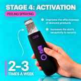 GESS YOU ultrasonic facial cleansing device 3 in 1 — ultrasonic peeling, phonophoresis, face scrubber, pore cleansing from blackheads, care for problem skin and skin with acne