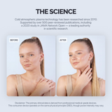 GESS Plasma Energy Skin Care Device